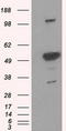 Proteasome 26S Subunit, ATPase 3 antibody, LS-C114990, Lifespan Biosciences, Western Blot image 