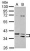 Ts Translation Elongation Factor, Mitochondrial antibody, GTX102238, GeneTex, Western Blot image 