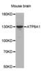 ATPIA antibody, abx002408, Abbexa, Western Blot image 