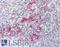 Lipopolysaccharide Induced TNF Factor antibody, LS-B8921, Lifespan Biosciences, Immunohistochemistry paraffin image 