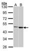 Galactose-3-O-Sulfotransferase 1 antibody, GTX104593, GeneTex, Western Blot image 