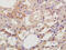 Diaphanous Related Formin 2 antibody, GTX51331, GeneTex, Immunohistochemistry paraffin image 