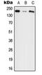 Agrin antibody, LS-C353868, Lifespan Biosciences, Western Blot image 
