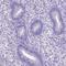 Prostaglandin E synthase antibody, PA5-60916, Invitrogen Antibodies, Immunohistochemistry paraffin image 