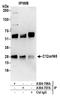 Chromosome 12 Open Reading Frame 45 antibody, A304-706A, Bethyl Labs, Immunoprecipitation image 
