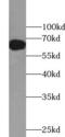 Solute Carrier Family 39 Member 4 antibody, FNab09641, FineTest, Western Blot image 
