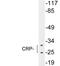 C-Reactive Protein antibody, LS-C199821, Lifespan Biosciences, Western Blot image 