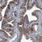 Leucine Rich Repeat Containing 6 antibody, HPA028058, Atlas Antibodies, Immunohistochemistry frozen image 