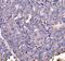 Drebrin 1 antibody, A05530-1, Boster Biological Technology, Immunohistochemistry paraffin image 
