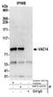 VAC14 Component Of PIKFYVE Complex antibody, NBP2-44278, Novus Biologicals, Western Blot image 