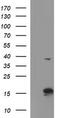 Ataxin 7 Like 1 antibody, M12910, Boster Biological Technology, Western Blot image 