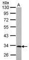 3-Hydroxyisobutyrate Dehydrogenase antibody, LS-C155743, Lifespan Biosciences, Western Blot image 