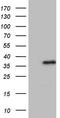 Aspartoacylase antibody, LS-C790543, Lifespan Biosciences, Western Blot image 