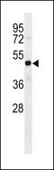 FEZ Family Zinc Finger 2 antibody, LS-C159643, Lifespan Biosciences, Western Blot image 