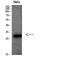 Programmed Cell Death 1 Ligand 2 antibody, STJ98748, St John