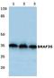SWI/SNF-related matrix-associated actin-dependent regulator of chromatin subfamily E member 1-related antibody, AP06758PU-N, Origene, Western Blot image 