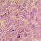 Vav Guanine Nucleotide Exchange Factor 2 antibody, LS-C368550, Lifespan Biosciences, Immunohistochemistry paraffin image 