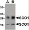 SCO Cytochrome C Oxidase Assembly Protein 1 antibody, orb86745, Biorbyt, Western Blot image 