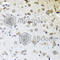 Carboxypeptidase A6 antibody, A6475, ABclonal Technology, Immunohistochemistry paraffin image 