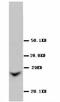 Gap Junction Protein Beta 1 antibody, LS-C172253, Lifespan Biosciences, Western Blot image 