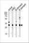 Esterase D antibody, A01471, Boster Biological Technology, Western Blot image 