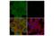 Tumor Associated Calcium Signal Transducer 2 antibody, 47866S, Cell Signaling Technology, Immunofluorescence image 