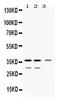 Dimethylarginine Dimethylaminohydrolase 1 antibody, PB10000, Boster Biological Technology, Western Blot image 