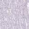 S100 Calcium Binding Protein A2 antibody, PA5-64022, Invitrogen Antibodies, Immunohistochemistry frozen image 