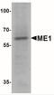 Malic Enzyme 1 antibody, NBP2-41267, Novus Biologicals, Western Blot image 