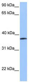 Ubiquitin Like Modifier Activating Enzyme 5 antibody, TA338681, Origene, Western Blot image 