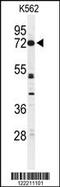 Cyclic Nucleotide Gated Channel Alpha 2 antibody, 61-685, ProSci, Western Blot image 