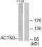 Actinin Alpha 3 (Gene/Pseudogene) antibody, abx013892, Abbexa, Western Blot image 