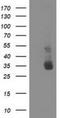 Non-Homologous End Joining Factor 1 antibody, NBP2-03275, Novus Biologicals, Western Blot image 