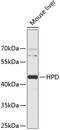 4-Hydroxyphenylpyruvate Dioxygenase antibody, 19-211, ProSci, Western Blot image 