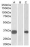 KChIP3 antibody, orb12340, Biorbyt, Western Blot image 