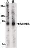 SLIT And NTRK Like Family Member 6 antibody, PA5-20480, Invitrogen Antibodies, Western Blot image 