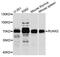 RUNX Family Transcription Factor 2 antibody, MBS127554, MyBioSource, Western Blot image 