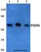 Podocan antibody, A10478, Boster Biological Technology, Western Blot image 