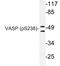 Vasodilator Stimulated Phosphoprotein antibody, LS-C178003, Lifespan Biosciences, Western Blot image 
