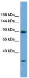 DENN Domain Containing 5A antibody, TA334066, Origene, Western Blot image 