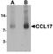 C-C Motif Chemokine Ligand 17 antibody, A02036, Boster Biological Technology, Western Blot image 