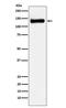 UPF1 RNA Helicase And ATPase antibody, M00900-2, Boster Biological Technology, Western Blot image 