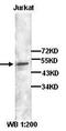 Decapping MRNA 2 antibody, orb77323, Biorbyt, Western Blot image 