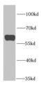 Polypyrimidine Tract Binding Protein 1 antibody, FNab06906, FineTest, Western Blot image 