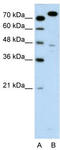 Minichromosome Maintenance Complex Component 3 antibody, TA341683, Origene, Western Blot image 