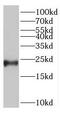 Troponin I2, Fast Skeletal Type antibody, FNab08839, FineTest, Western Blot image 
