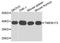 Transmembrane Protein 173 antibody, A3575, ABclonal Technology, Western Blot image 