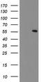 Carnosine Dipeptidase 2 antibody, TA503631, Origene, Western Blot image 