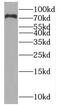 PWWP Domain Containing 3A, DNA Repair Factor antibody, FNab05437, FineTest, Western Blot image 