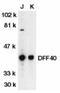 DNA Fragmentation Factor Subunit Beta antibody, NBP1-76884, Novus Biologicals, Western Blot image 